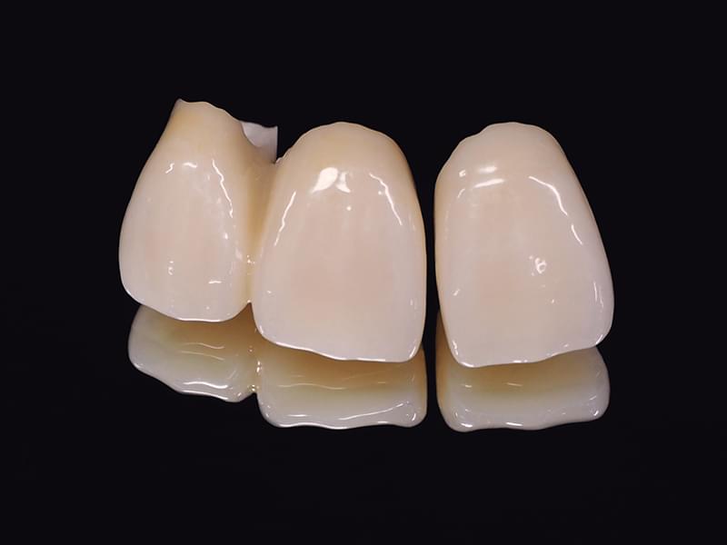 セラミックとは