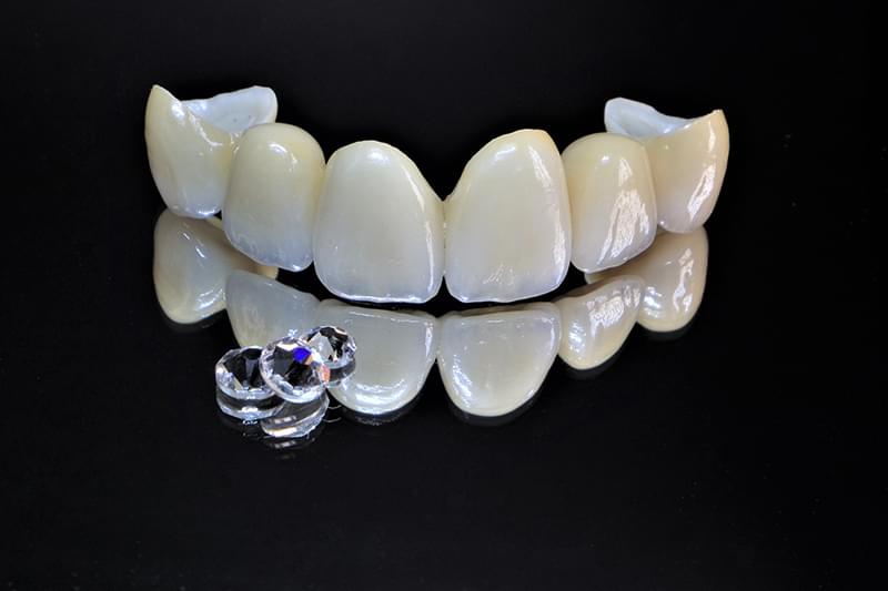 オールセラミッククラウン