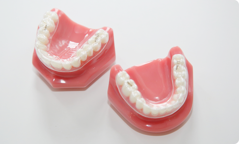 笑顔のための総合的矯正治療