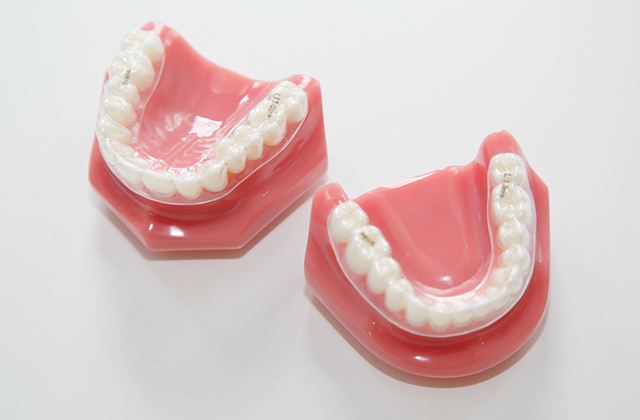 笑顔のための総合的矯正治療